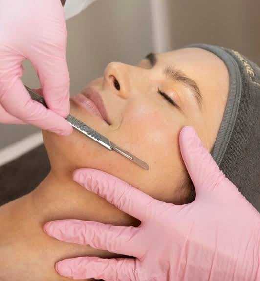 Person receiving a facial dermaplaning treatment by an esthetician wearing pink gloves.